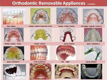 Orthodontics treatment images