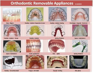 Removable appliances of Othodontic treatment